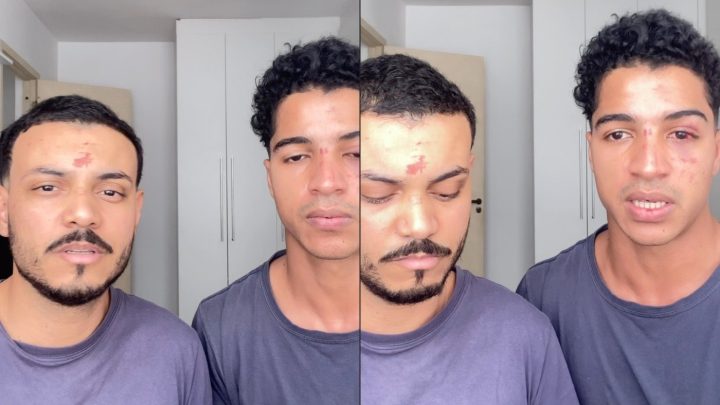 Aluno relata agressão e homofobia que sofreu com o namorado após festa em prédio da UFRJ