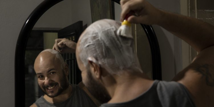Dos fiozinhos soltos à proteção solar: como homens com calvície podem cuidar da careca no dia a dia