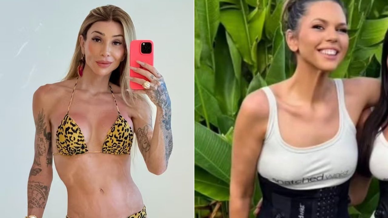 Remodelamento de costelas: cirurgia para afinar a cintura cresce nas redes; há riscos?