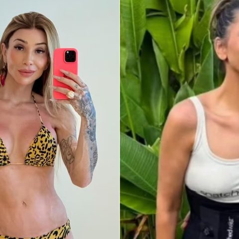 Remodelamento de costelas: cirurgia para afinar a cintura cresce nas redes; há riscos?