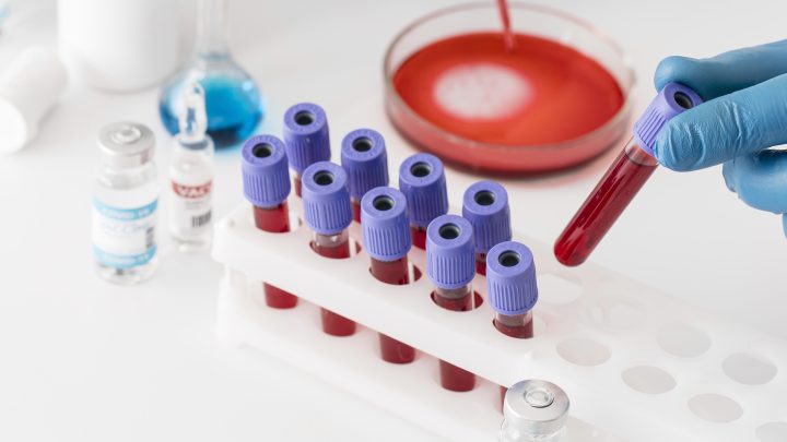 Câncer: exame de sangue que detecta mais de 50 tipos da doença chega ao país